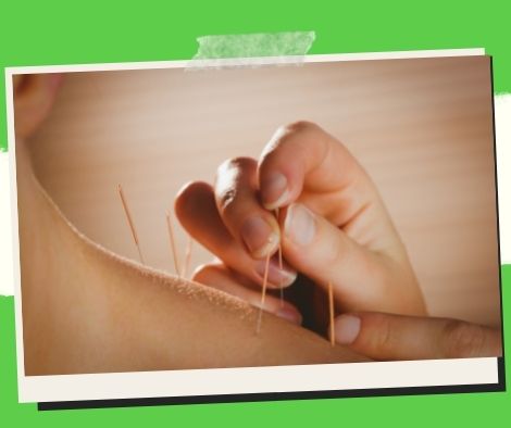 Acupuncture can help you quit smoking for good.
